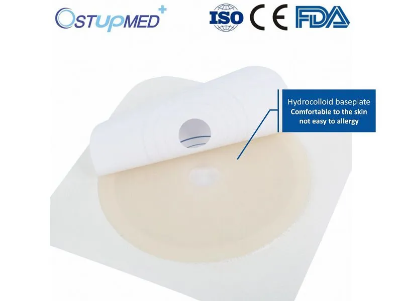 حلقة كيس فغر القولون